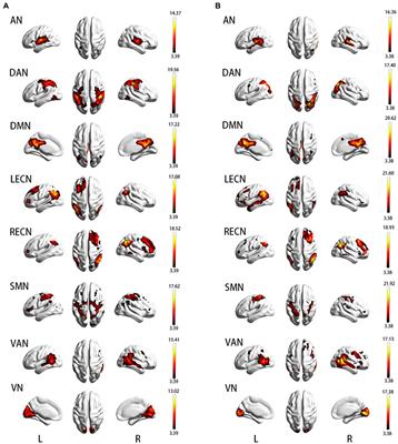 Differences in resting-state brain networks and gray matter between APOE ε2 and APOE ε4 carriers in non-dementia elderly